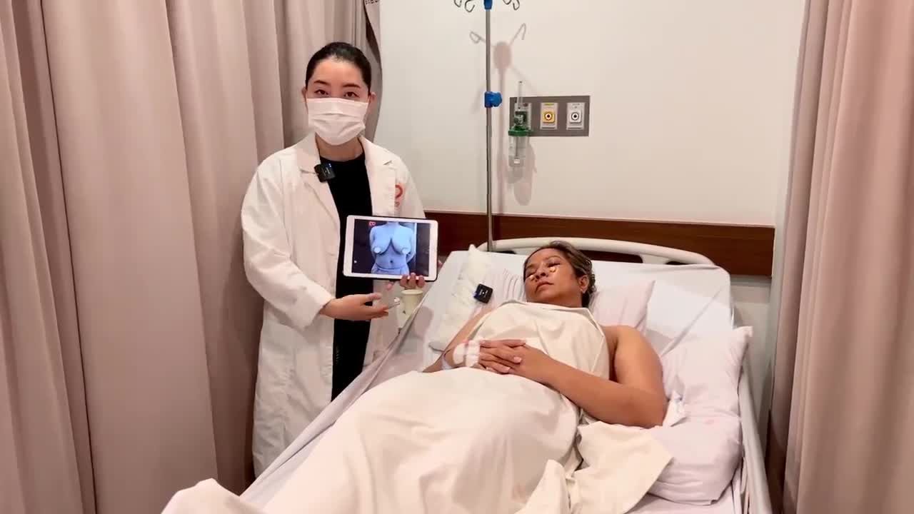FEEDBACK KHÁCH HÀNG SAU THU GỌN NGỰC PHÌ ĐẠI + CẮT MÍ TẠI DR.D