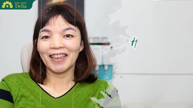 BỌC RĂNG SỨ - HÀNH TRÌNH TÌM LẠI NỤ CƯỜI TỰ TIN