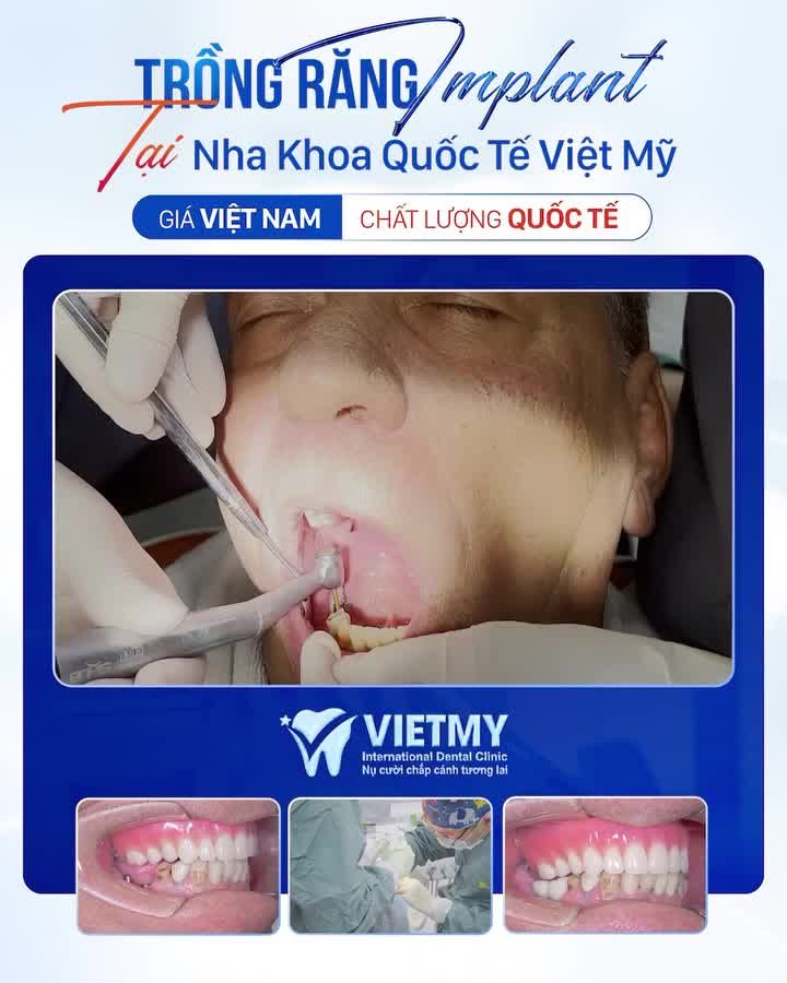 KHI NGÔN NGỮ KHÔNG CÒN LÀ RÀO CẢN!