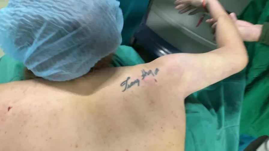 Hút mỡ cánh tay cho bạn gái Quảng Ninh !