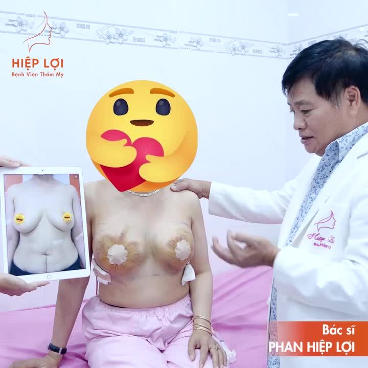 HOT NỖI ÁM ẢNH sẹo chữ T, kẹo mút khi đi nâng ngực hoàn toàn được xóa bỏ với Phương pháp độc quyền TÁI TẠO NGỰC SA TRỄ từ Bệnh viện Thẩm mỹ Hiệp Lợi: