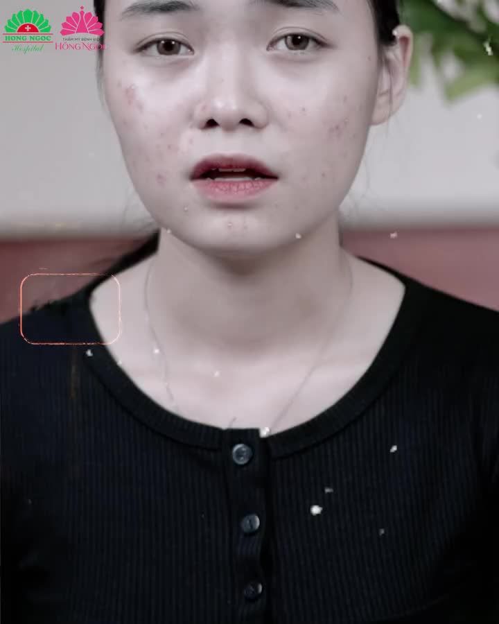 TREATMENT THEO REVIEW CÔ GÁI NHẬN CÁI KẾT ĐẮNG