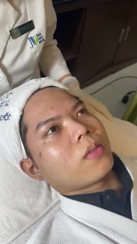 Nam sinh khổ sở vì SẸO RỖ CHI CHÍT đến JW cải thiện làn da MỊN MÀNG không tì vết