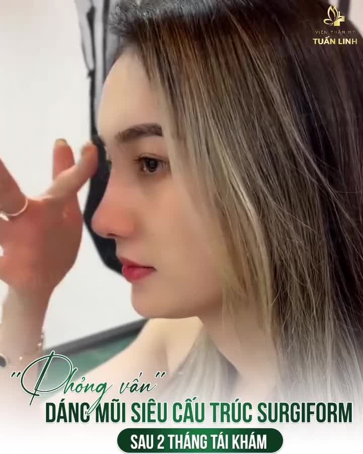 Chia sẻ của khách hàng sau 2 tháng nâng mũi siêu cấu trúc Surgiform!! -Thời điểm VÀNG nâng mũi đón TẾT là đây đó ạ!