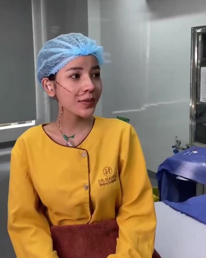 Phỏng vấn nhanh em gái vừa thực hiện Nâng mũi tại cơ sở HCM bất ngờ với câu kết