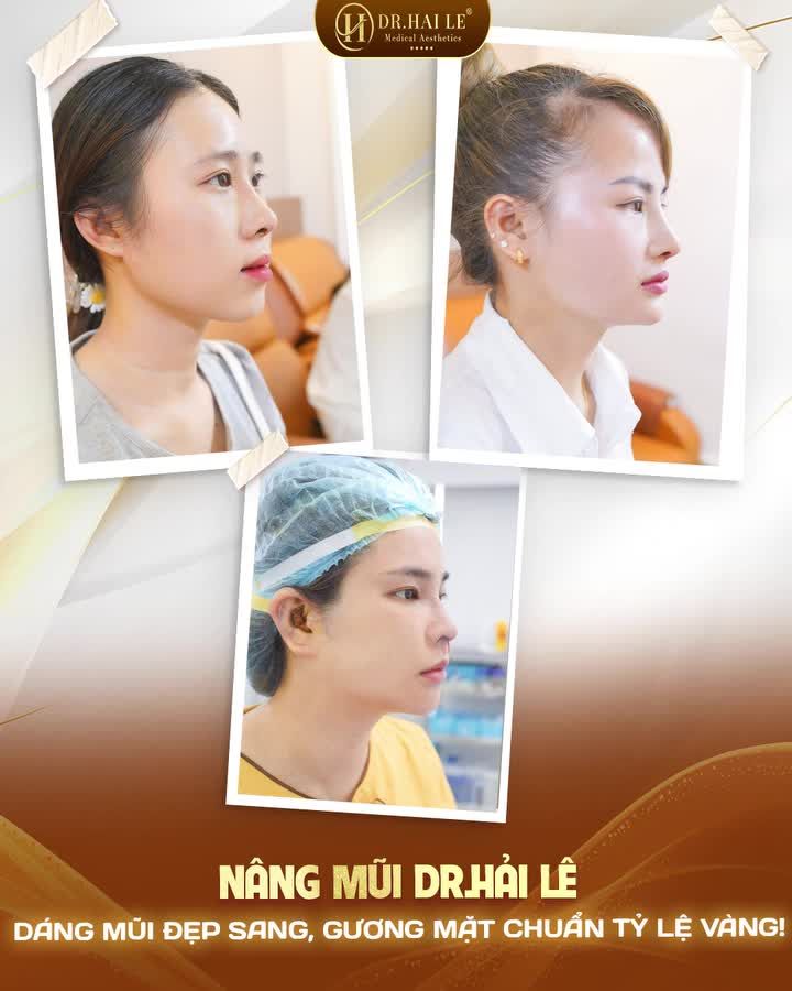 60 phút thực hiện nhẹ nhàng, ít xâm lấn, không gây đau đớn kéo dài.