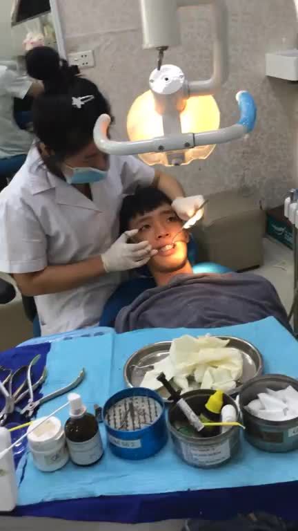 Hành trình Niềng răng sau 1 năm của khách hàng Ngô Quý Cử tại Nha Khoa Smile One