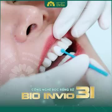 Răng ố vàng, khấp khểnh, răng thưa, từng bọc sứ hỏng