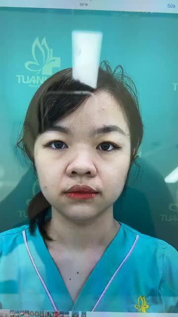 Case mũi cấu trúc vừa hoàn thành