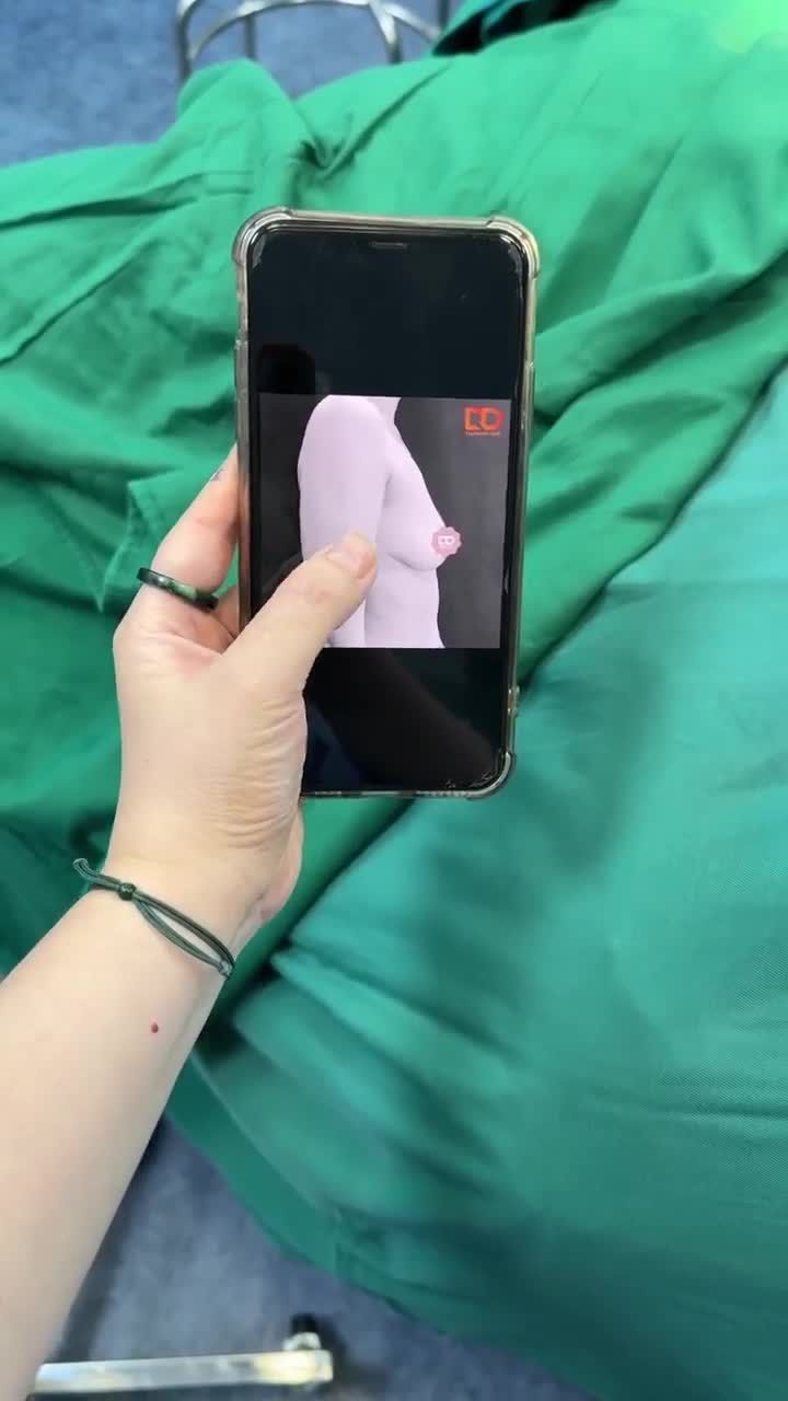 TREO SA TRỄ ĐỘ 2 + ĐẶT TÚI ĐỘN NANOCHIP ERGONOMIX - V1 SIÊU ĐẸP