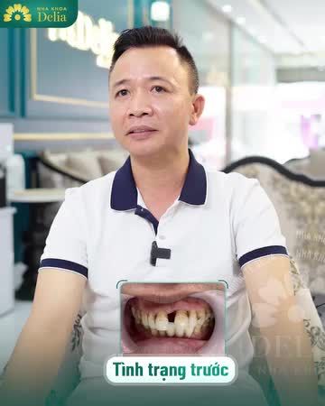  Chứng kiến màn “biến hình” của anh Độ với nụ cười quý ông lịch lãm tại nha khoa Delia nhé!