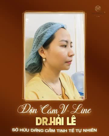 Tại sao ánh mắt của mọi người lại đổ dồn về đường nét thanh tú, mềm mại của chiếc cằm V-line hiện diện trên khuôn mặt của các chị em?