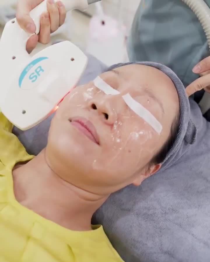 Điều trị tàn nhang 1 lần duy nhất công nghệ ánh sáng Elos hiệu quả vượt trội như thế nào? Theo dõi ngay