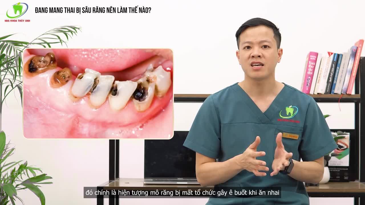 ​​​​​​​Đang mang thai bị sâu răng đau tủy thì các mẹ cần xử lý như thế nào?