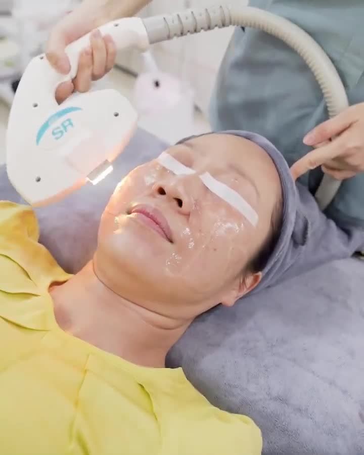 Điều trị tàn nhang 1 lần duy nhất công nghệ Elos hiệu quả vượt trội như thế nào? Theo dõi ngày