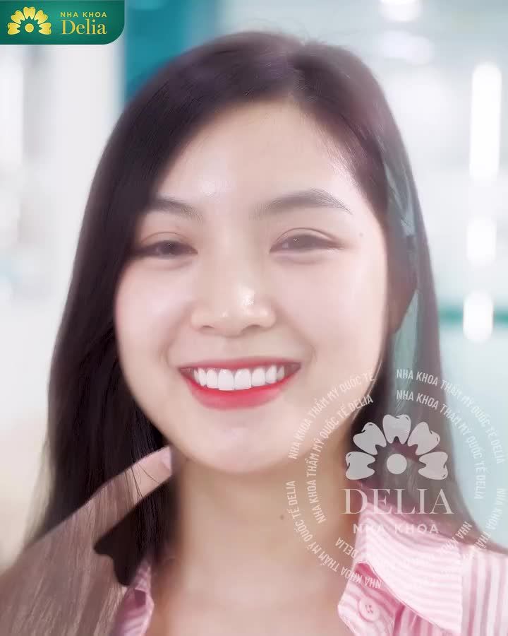 Không chỉ cam kết mang tới cho khách hàng chất lượng dịch vụ răng sứ tốt nhất, Nha khoa Delia còn luôn có những ưu đãi lớn tri ân sự yêu mến và tin tưởng của quý khách hàng trong suốt 5 năm qua.