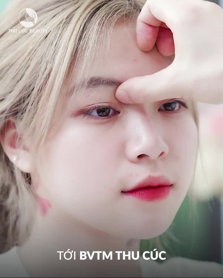 Làm gì để có nếp mí đẹp