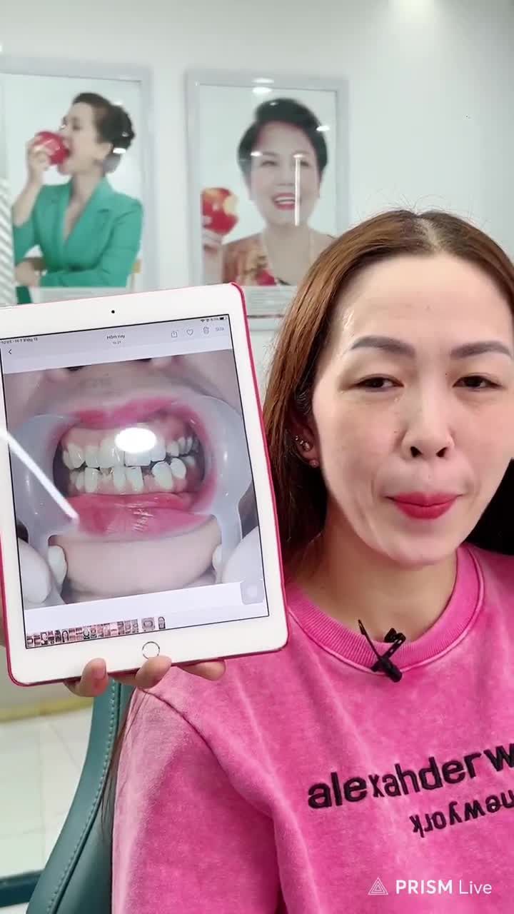 Chị gái từ Ninh Bình được rất nhiều bạn bè giới thiệu đã tin tưởng ra Hà Nội và chọn Delia để thay đổi nụ cười.