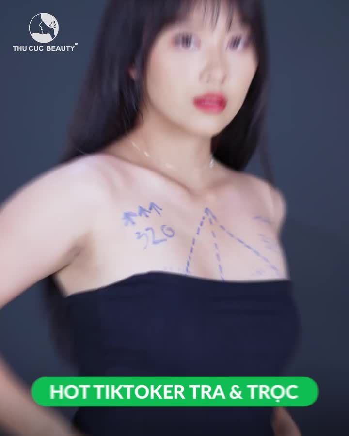 Nâng ngực Thu Cúc tự tin quyến rũ