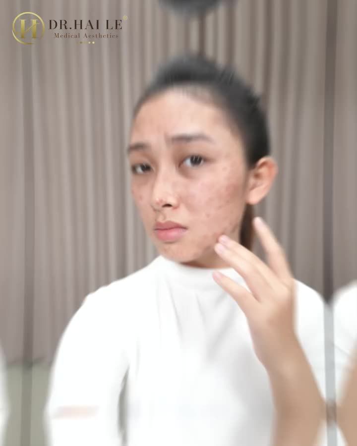 Làm đẹp đã và đang là nhu cầu cần thiết đối với các chị em phụ nữ.