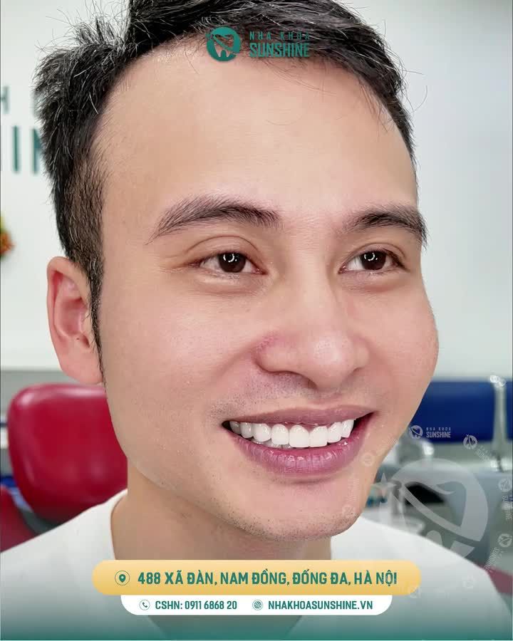 ĐÃ MÀI RĂNG Ở CHỖ KHÁC, NHƯNG VẪN QUYẾT ĐỊNH TÌM ĐẾN SUNSHINE ĐỂ HOÀN THIỆN, BỞI