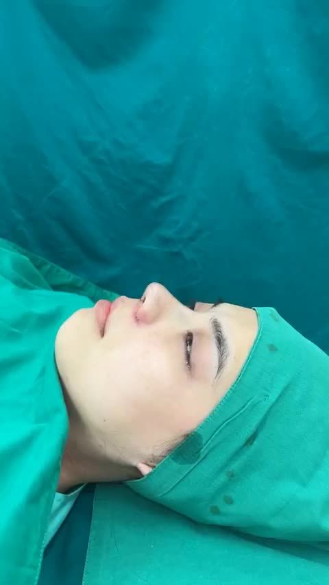 Case mũi cấu trúc vừa hoàn thành