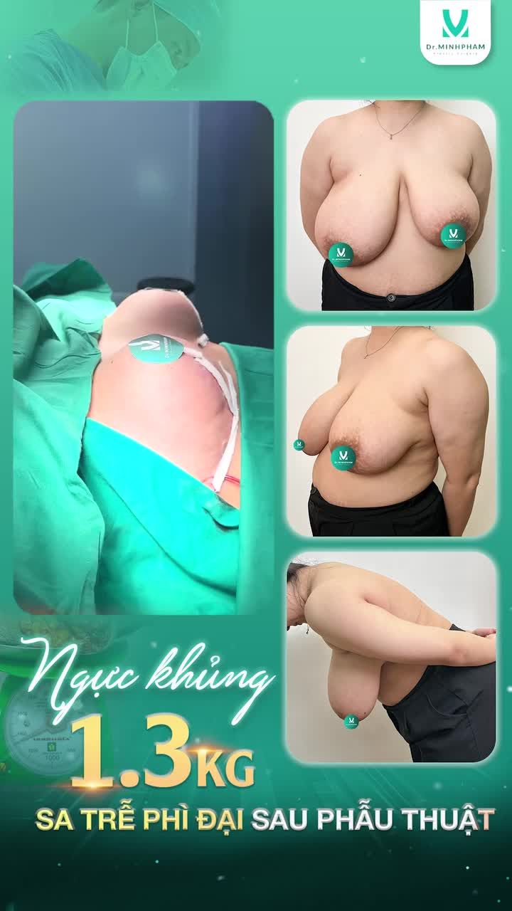 Thêm 1 bông hoa xinh đẹp đã lột xác thành công, chuẩn bị tỏa hương rực rỡ Đã gọi là điêu khắc body thì nó phải ở cái tầm này chứ
