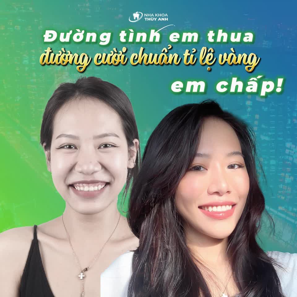 NỤ CƯỜI KHÔNG HỞ LỢI QUAN TRỌNG ĐẾN THẾ SAO ??