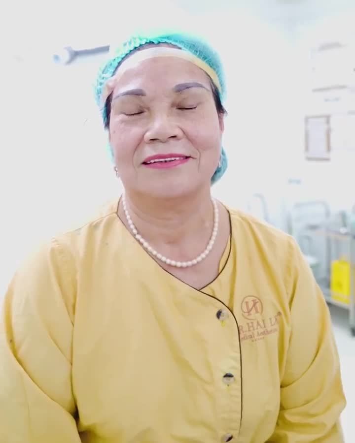 Nâng cung mày, giải pháp vàng giúp khách hàng U50++ lấy lại đôi mắt trẻ sang