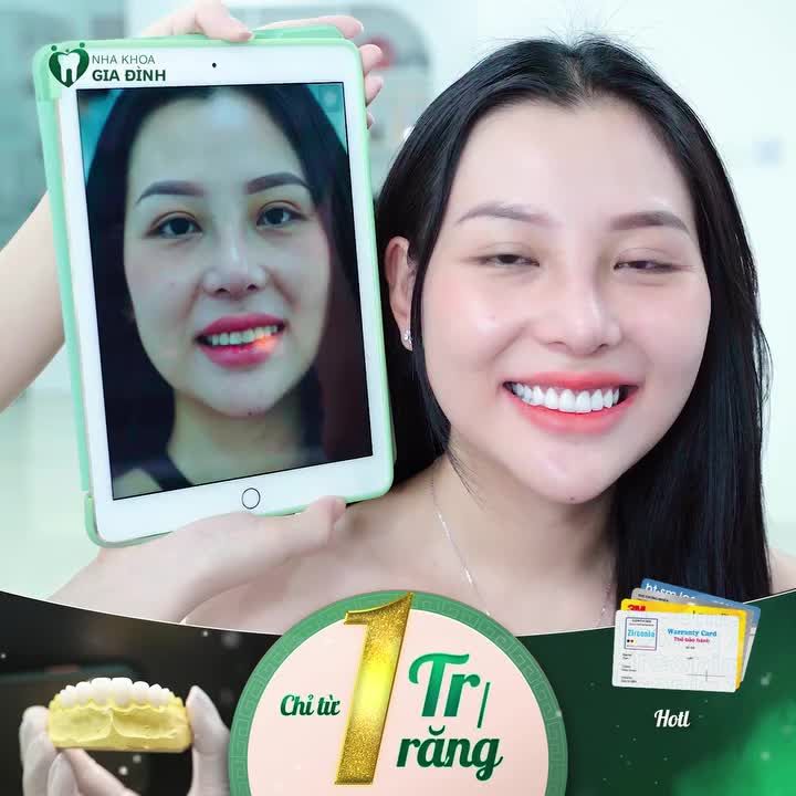 ƯU ĐÃI DÀNH CHO TẤT CẢ CÁC ANH CHỊ ĐANG XEM VIDEO NÀY