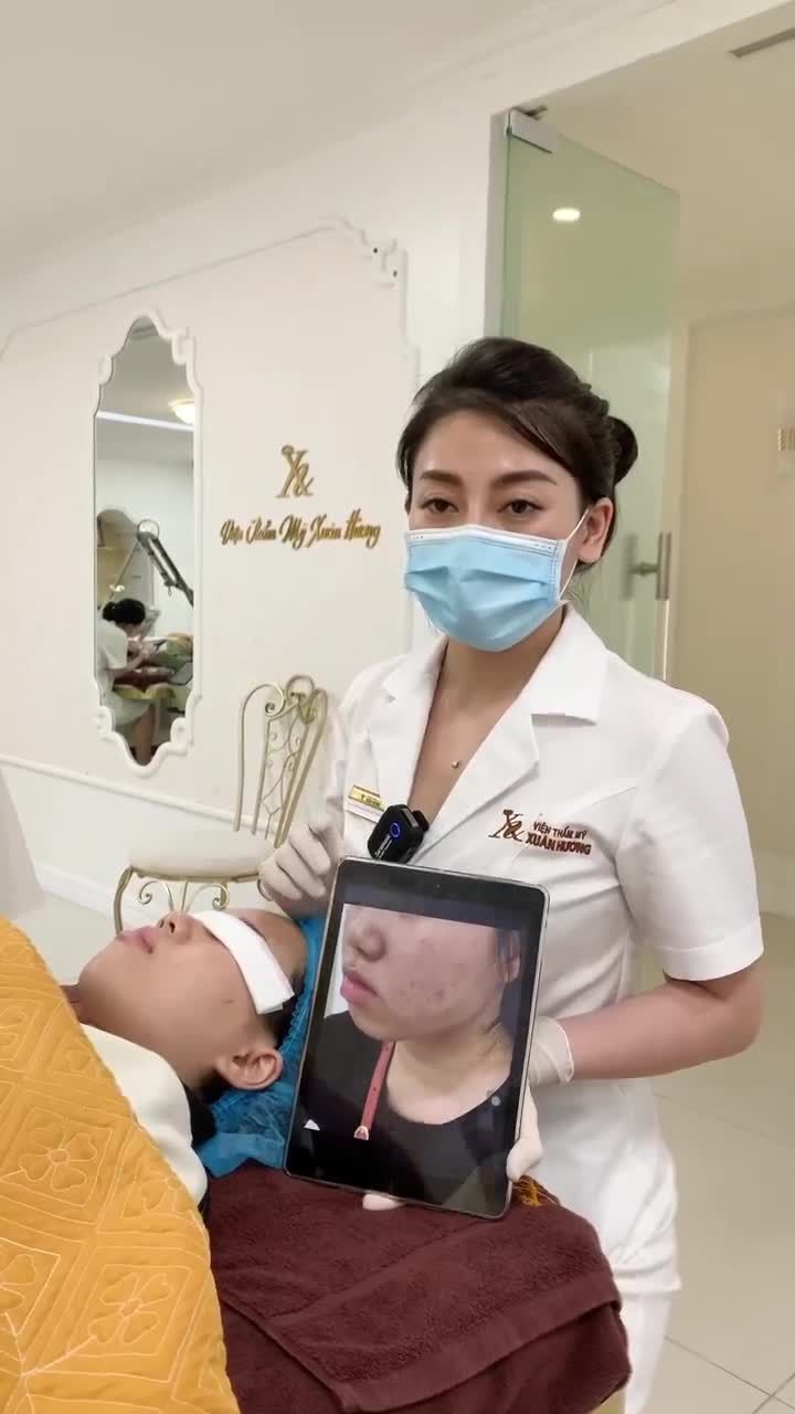 Da hết sạch mụn đón Tết thêm xinh