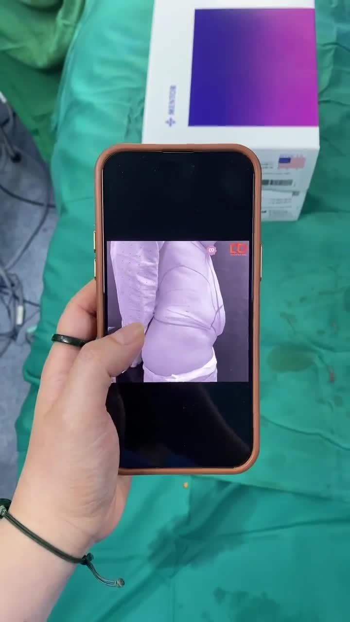 KHÁCH HÀNG THỰC HIỆN COMBO: NÂNG V1 + TẠO HÌNH V2