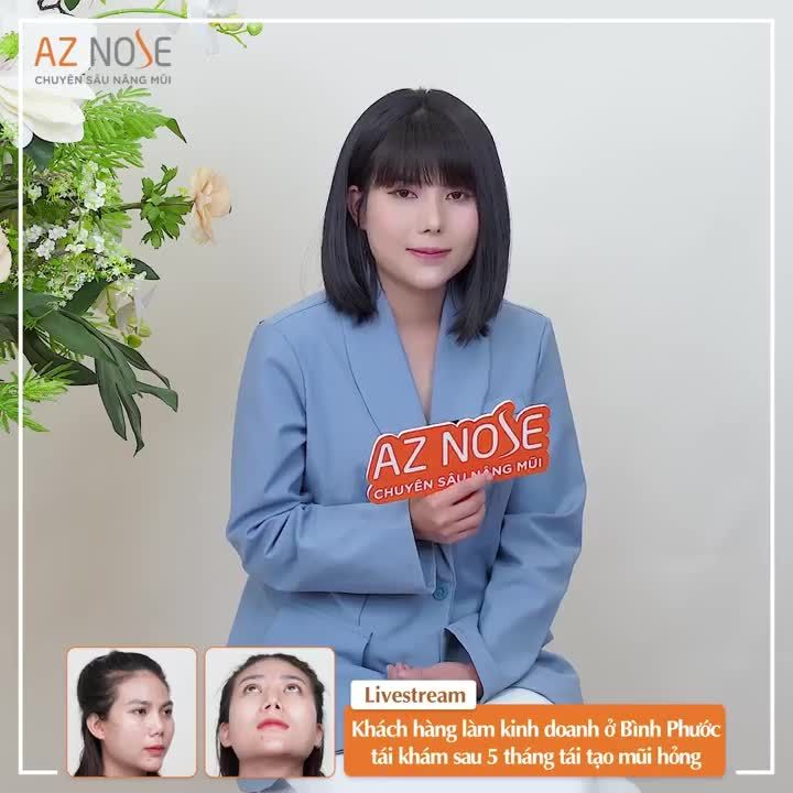 Cảm nhận của khách hàng làm kinh doanh ở Bình Phước sau 5 tháng tái tạo mũi hỏng.