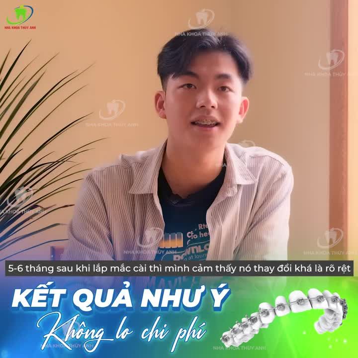 SỞ HỮU NỤ CƯỜI LÝ TƯỞNG, VỪA HAY CÓ DEAL HỜI NIỀNG RĂNG