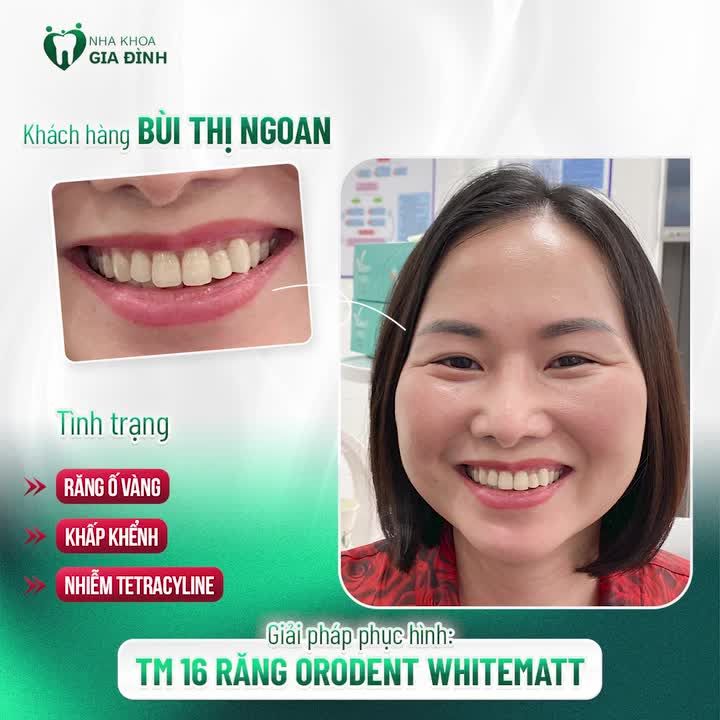 CHỊ GÁI VỚI KHUÔN TRĂNG ĐẦY ĐẶN NÉT NGÀI NỞ NANG NAY CÓ THÊM VŨ KHÍ BÍ MẬT GIÚP MÌNH CƯỜI XINH
