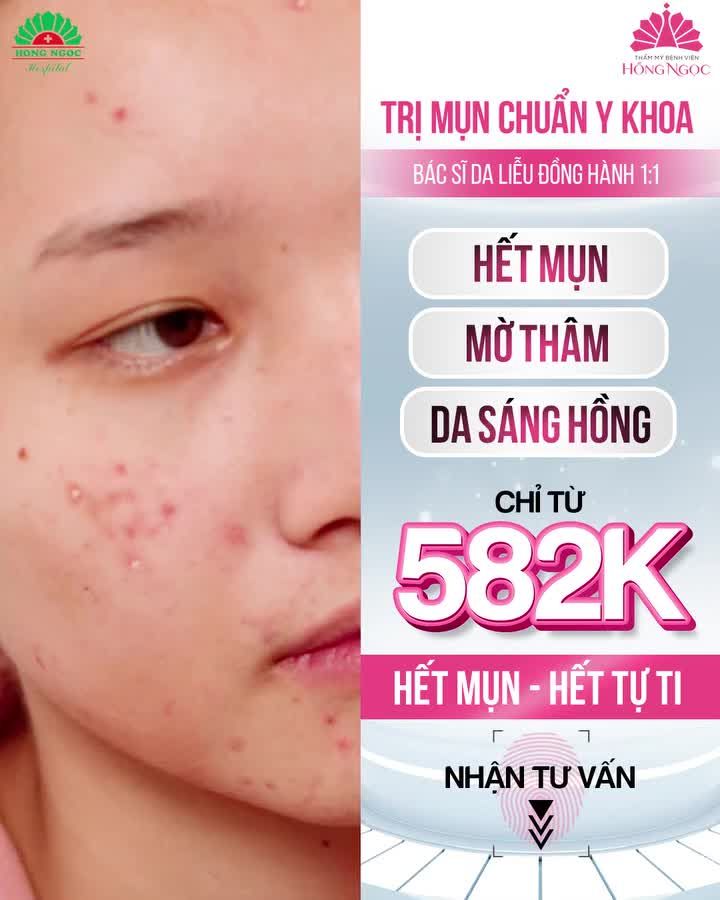 Review chân thực quá trình trị mụn Chuẩn Y Khoa của Ngọc Huyền