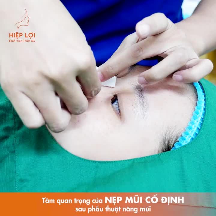 "NHIỆM VỤ" CỦA CHIẾC NẸP NÂNG MŨI