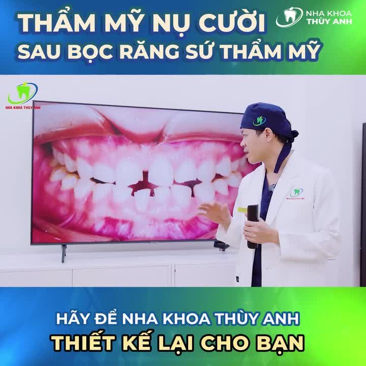 SỨC SỐNG MỚI SAU KHI ''THAY ÁO" CHO HÀM RĂNG NHIỀU KHUYẾT ĐIỂM