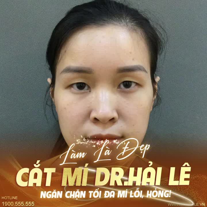 Chỉ có nụ cười mới có thể "tỏa nắng"?  Bạn đã nhầm, đôi mắt 2 mí sắc nét cũng có "quyền năng" thu hút người đối diện.