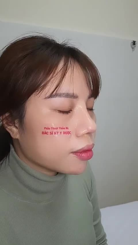 DÁNG MŨI CAO XINH – TỰ TIN VỚI CÁC GÓC NGHIÊNG