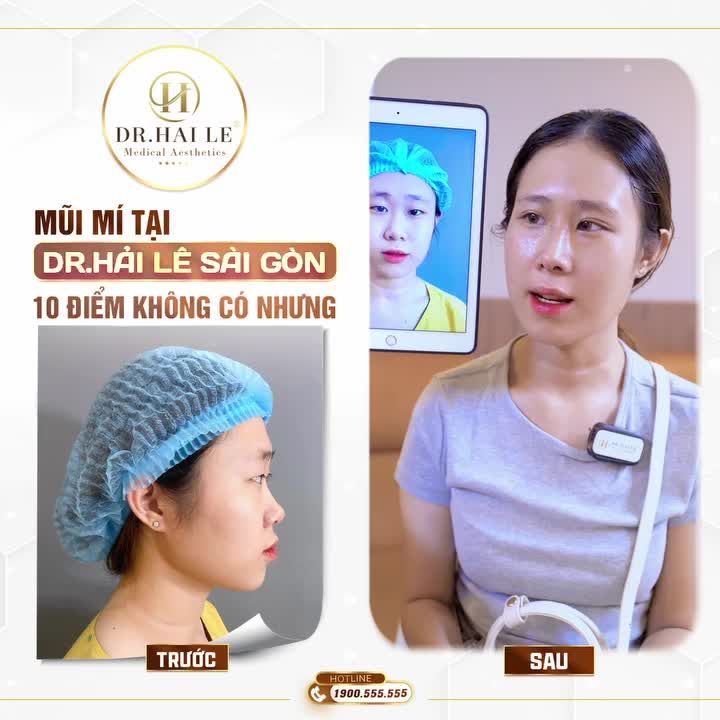 "Em tự tin lên gần 100%", "Làm mũi mí nhưng vẫn giữ được nét hài hòa, tự nhiên, nhìn không bị giả', "mẹ không nhận ra em..."