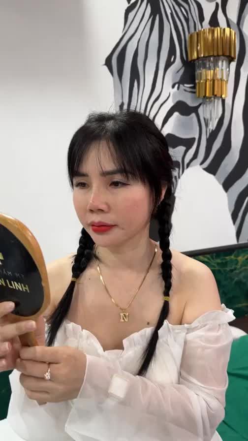 Case mũi bán cấu trúc sau 10 ngày