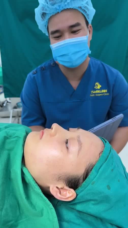 Ca nâng mũi cấu trúc vừa hoàn thành