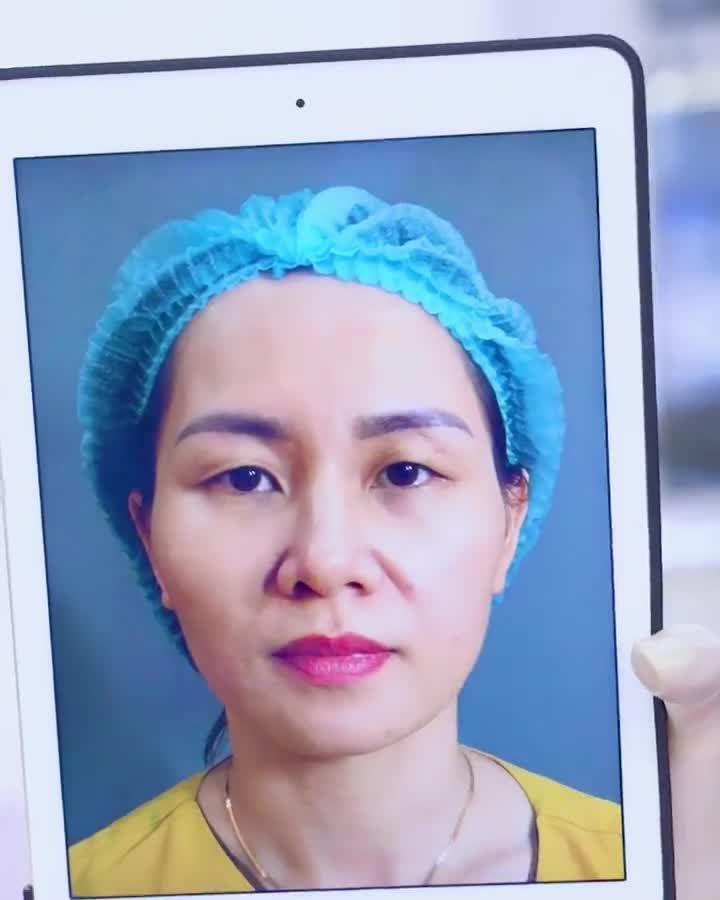 Trẻ hóa đôi mắt đẹp rạng ngời chuẩn bị đón Tết vị khách hàng nói gì? Theo dõi ngay