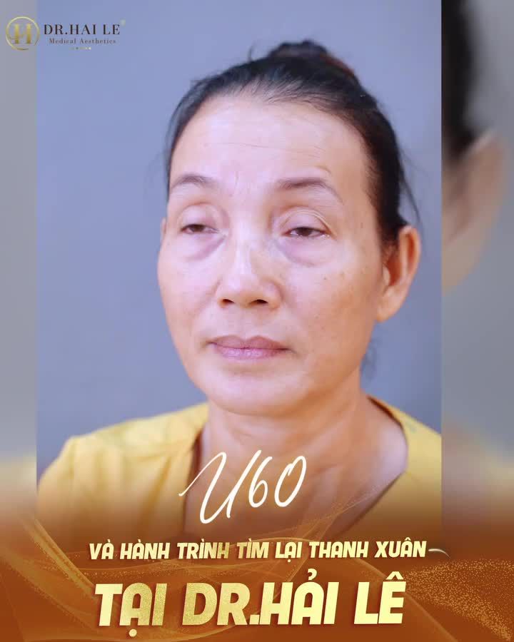 Từng đi khắp nơi tìm hiểu nhưng chưa dám giao đôi mắt mình cho bất kỳ cơ sở nào.