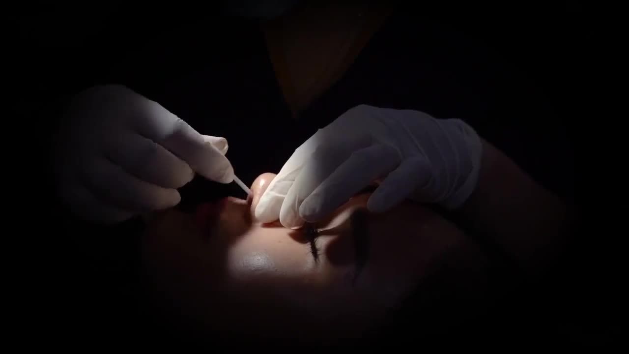 Nâng mũi Vip Medi Surform sau 10 trông sẽ như thế nào? Theo dõi ngay