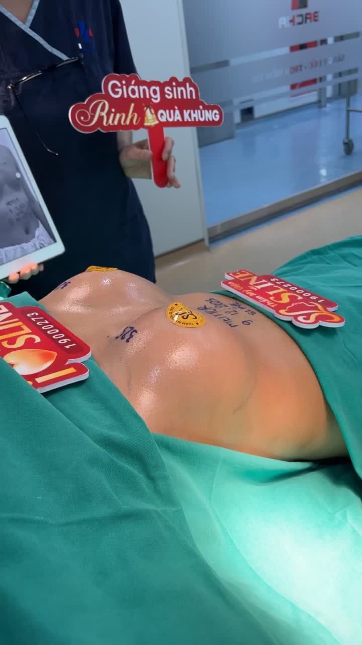 TÚI MENTOR 325CC Cho bạn nữ ít mô tuyến