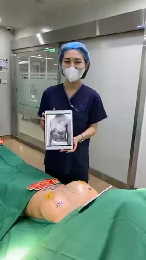 VÒNG 1 CÓ TUYẾN NHƯNG CHƯA CĂNG TRÒN