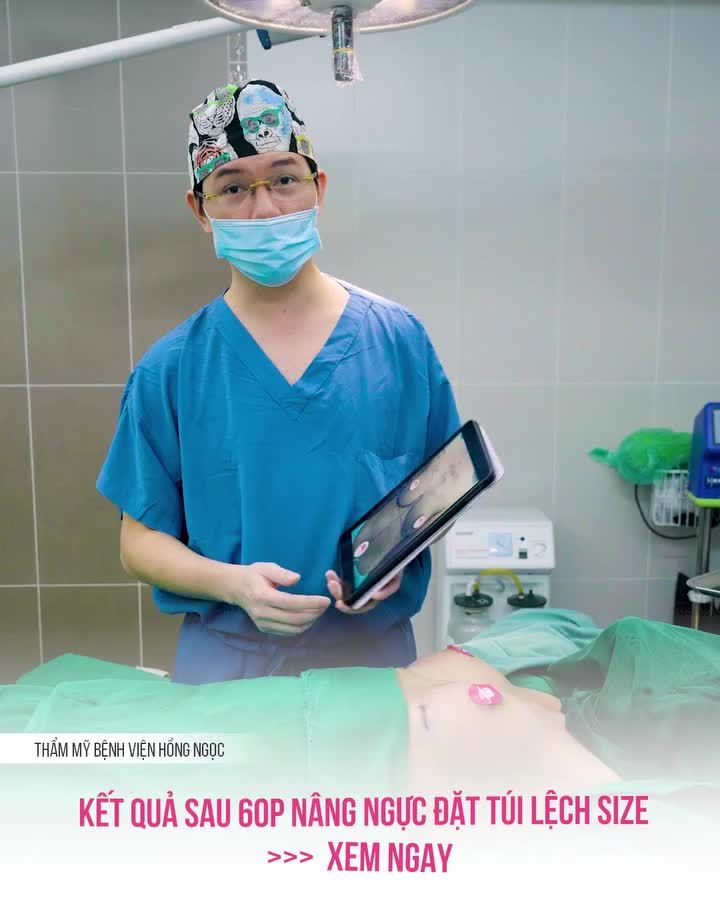 Chưa đầy 1h bác sĩ Tuấn Anh đã hoàn thành ca nâng V1 Dual Plane cho chị khách hàng