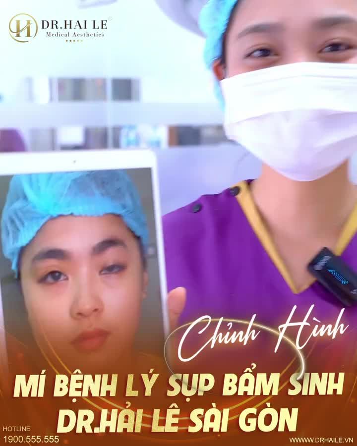 CHỈNH HÌNH MÍ BỆNH LÝ SỤP BẨM SINH- DR.HẢI LÊ SÀI GÒN